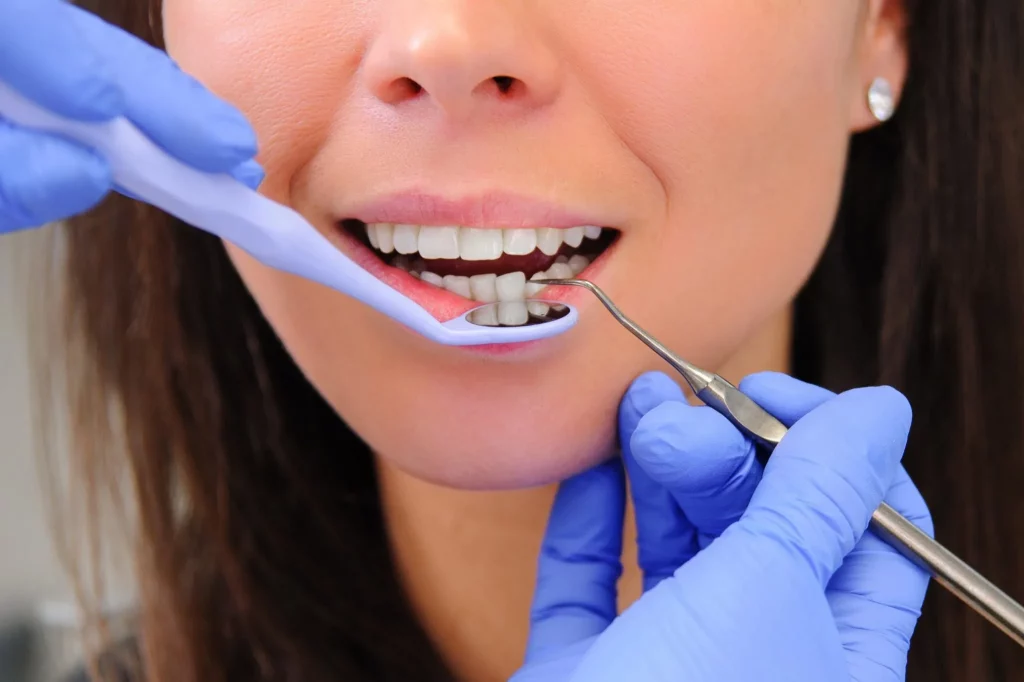 профилактические меры зубов